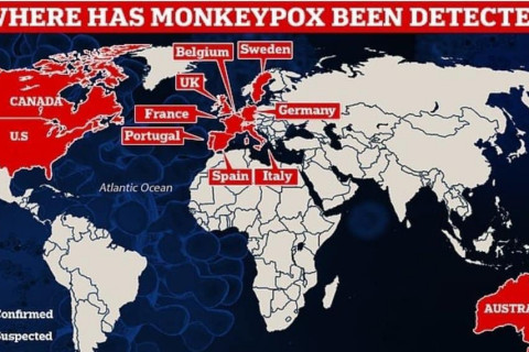 Европт сармагчны цэцэг өвчний халдварын тохиолдол 100 давсантай холбоотой ДЭМБ шуурхай хурал зарлав